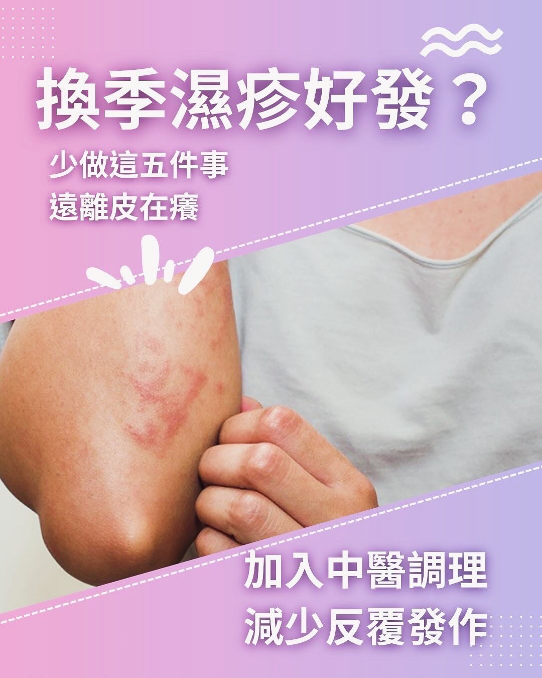 換季濕疹好發?五件事要注意!!!